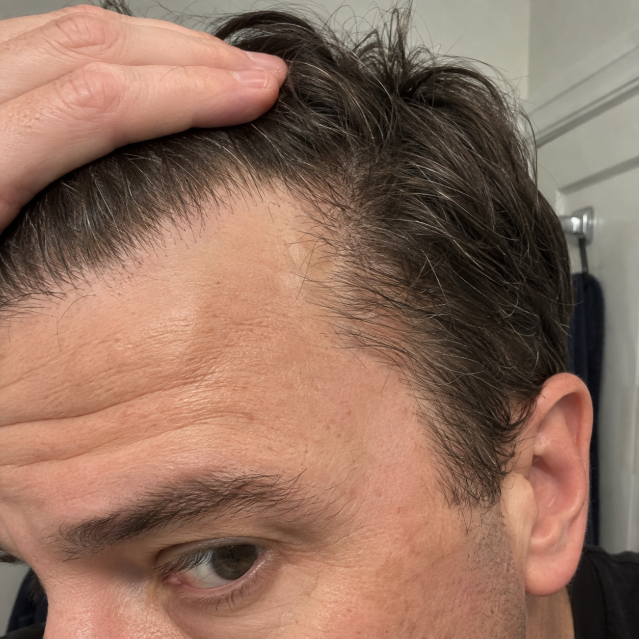 Fuller, stronger hairline close-up