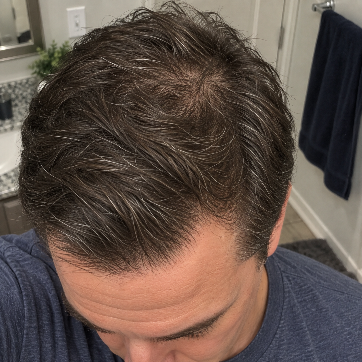Fuller crown and part after months of use