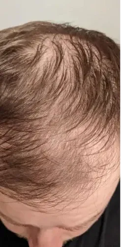 James T. before