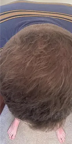 Mark R. after