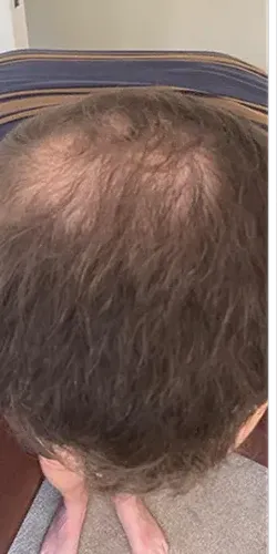 Mark R. before